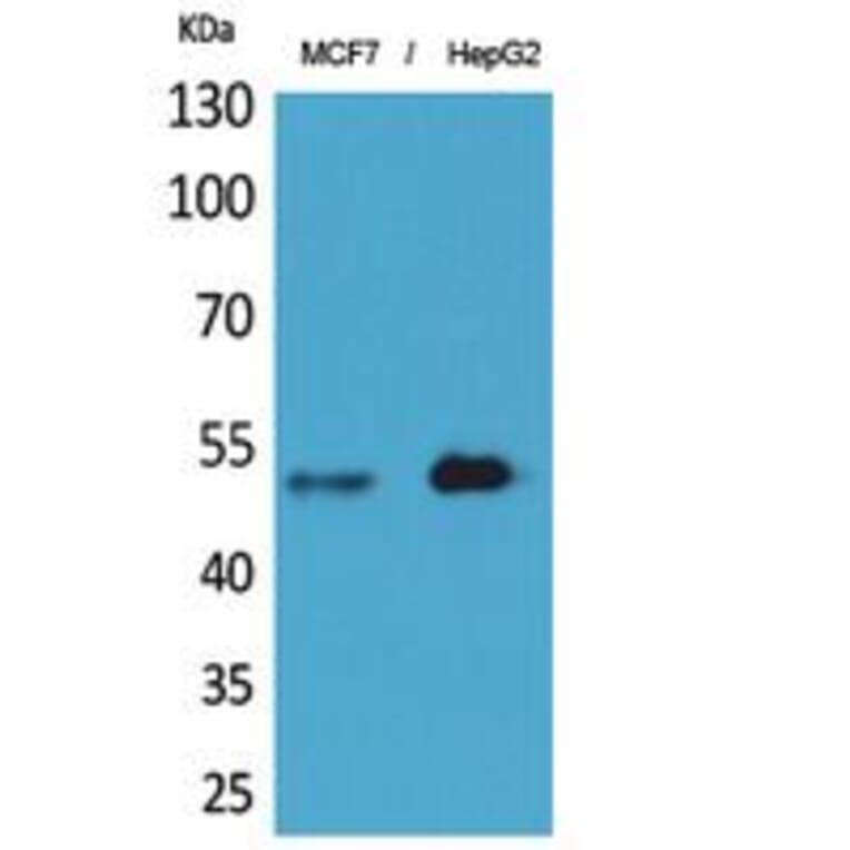 Western blot - LIR-6 Polyclonal Antibody from Signalway Antibody (41839) - Antibodies.com