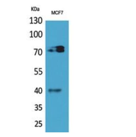 Western blot - CD110 Polyclonal Antibody from Signalway Antibody (41841) - Antibodies.com