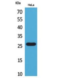 Western blot - DCL-1 Polyclonal Antibody from Signalway Antibody (41845) - Antibodies.com
