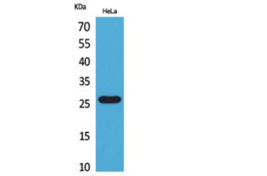 Western blot - DCL-1 Polyclonal Antibody from Signalway Antibody (41845) - Antibodies.com