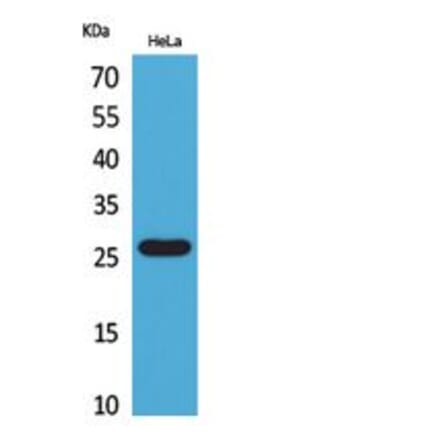 Western blot - DCL-1 Polyclonal Antibody from Signalway Antibody (41845) - Antibodies.com