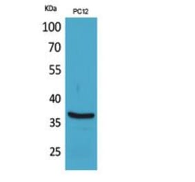 Western blot - BST-1 Polyclonal Antibody from Signalway Antibody (41847) - Antibodies.com