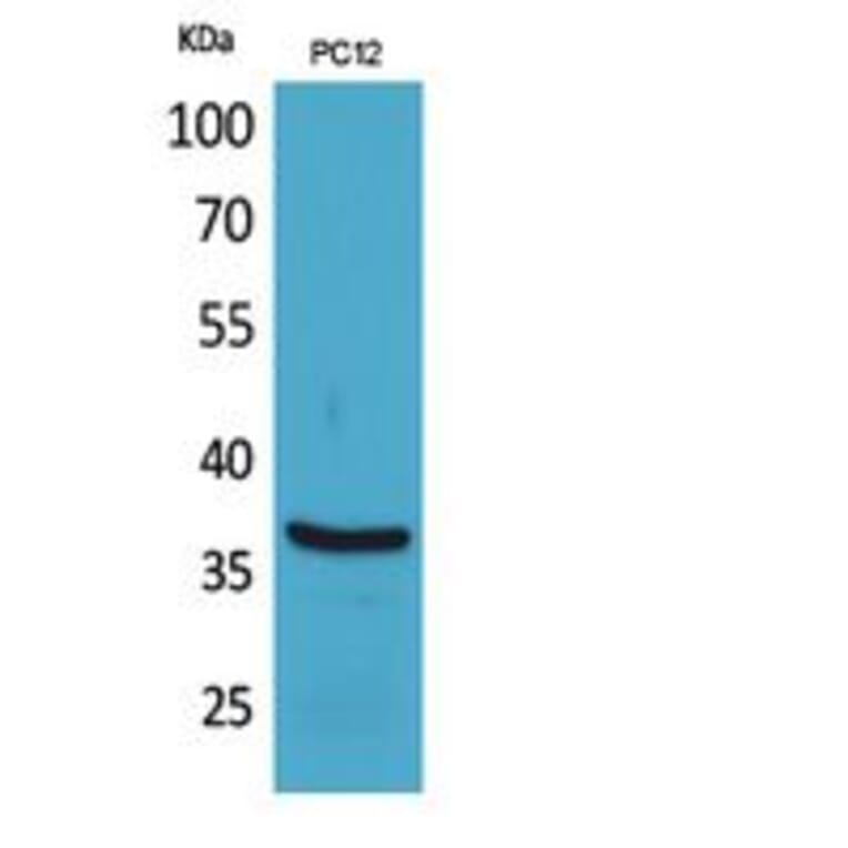 Western blot - BST-1 Polyclonal Antibody from Signalway Antibody (41847) - Antibodies.com