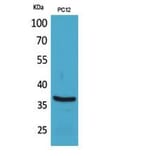 Western blot - BST-1 Polyclonal Antibody from Signalway Antibody (41847) - Antibodies.com