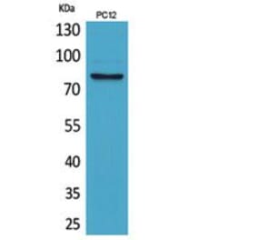Western blot - CD239 Polyclonal Antibody from Signalway Antibody (41848) - Antibodies.com