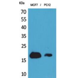 Western blot - CD225 Polyclonal Antibody from Signalway Antibody (41849) - Antibodies.com