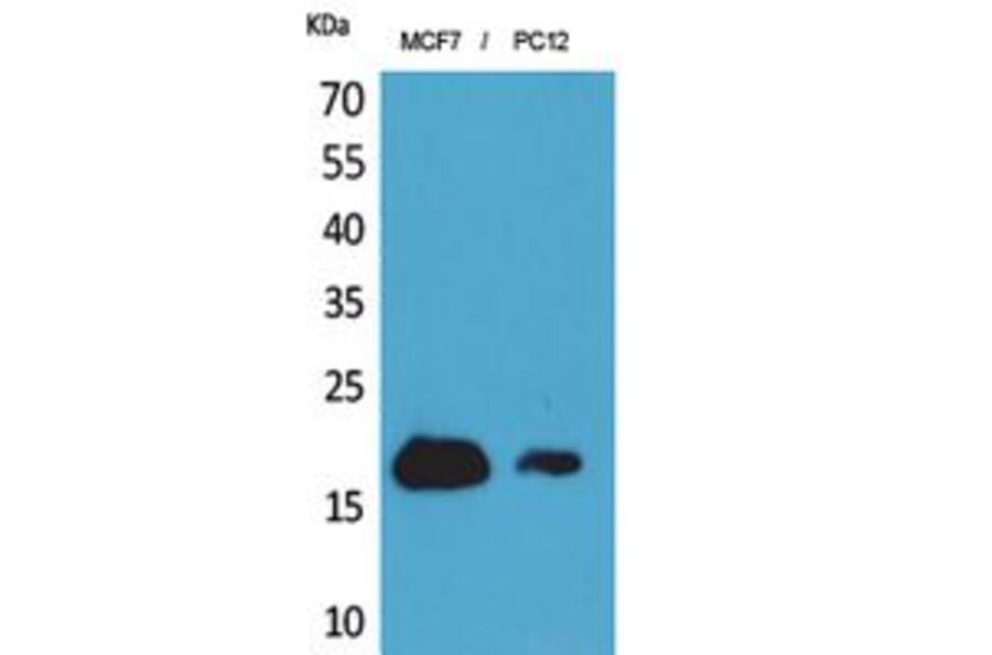 Western blot - CD225 Polyclonal Antibody from Signalway Antibody (41849) - Antibodies.com