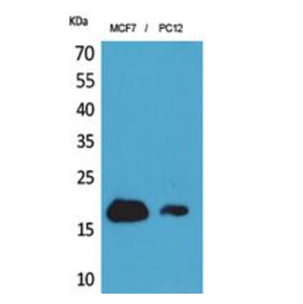 Western blot - CD225 Polyclonal Antibody from Signalway Antibody (41849) - Antibodies.com