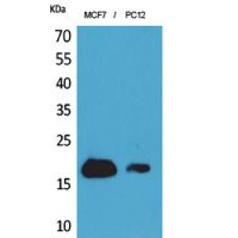 Western blot - CD225 Polyclonal Antibody from Signalway Antibody (41849) - Antibodies.com
