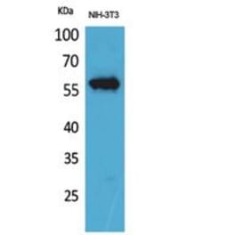 Western blot - CD223 Polyclonal Antibody from Signalway Antibody (41851) - Antibodies.com