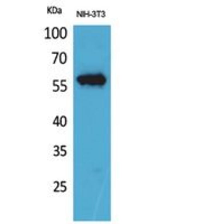 Western blot - CD223 Polyclonal Antibody from Signalway Antibody (41851) - Antibodies.com
