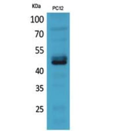 Western blot - NKp44 Polyclonal Antibody from Signalway Antibody (41852) - Antibodies.com