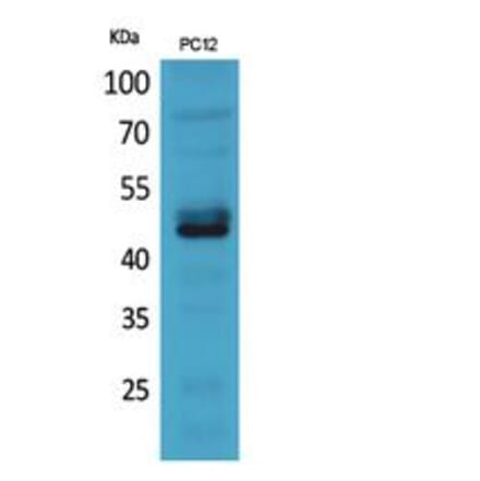 Western blot - NKp44 Polyclonal Antibody from Signalway Antibody (41852) - Antibodies.com