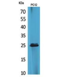 Western blot - CMTM5 Polyclonal Antibody from Signalway Antibody (41856) - Antibodies.com