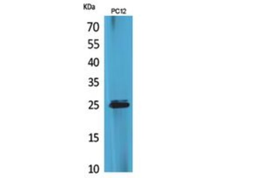 Western blot - CMTM5 Polyclonal Antibody from Signalway Antibody (41856) - Antibodies.com