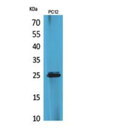 Western blot - CMTM5 Polyclonal Antibody from Signalway Antibody (41856) - Antibodies.com