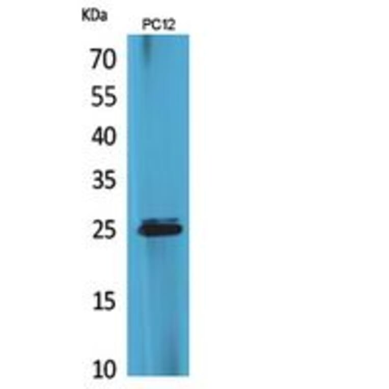 Western blot - CMTM5 Polyclonal Antibody from Signalway Antibody (41856) - Antibodies.com