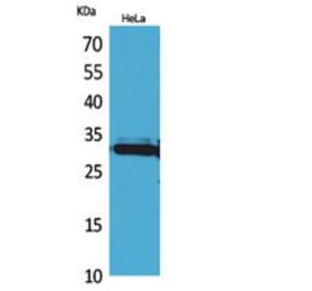 Western blot - IL-33 Polyclonal Antibody from Signalway Antibody (41858) - Antibodies.com