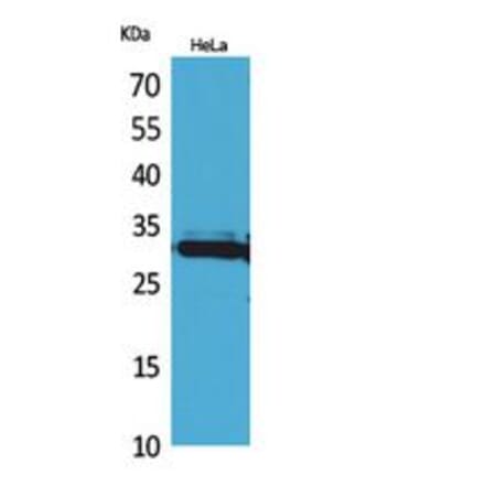 Western blot - IL-33 Polyclonal Antibody from Signalway Antibody (41858) - Antibodies.com