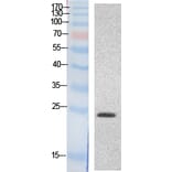 Western blot - HMG-1 Polyclonal Antibody from Signalway Antibody (41867) - Antibodies.com