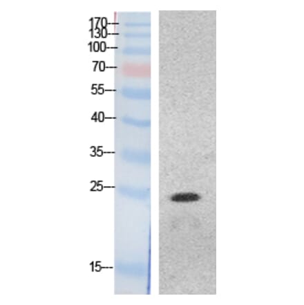 Western blot - HMG-1 Polyclonal Antibody from Signalway Antibody (41873) - Antibodies.com
