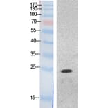 Western blot - HMG-1 Polyclonal Antibody from Signalway Antibody (41873) - Antibodies.com