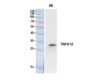 Western blot - TRAIL Polyclonal Antibody from Signalway Antibody (41881) - Antibodies.com