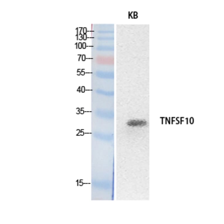 Western blot - TRAIL Polyclonal Antibody from Signalway Antibody (41881) - Antibodies.com