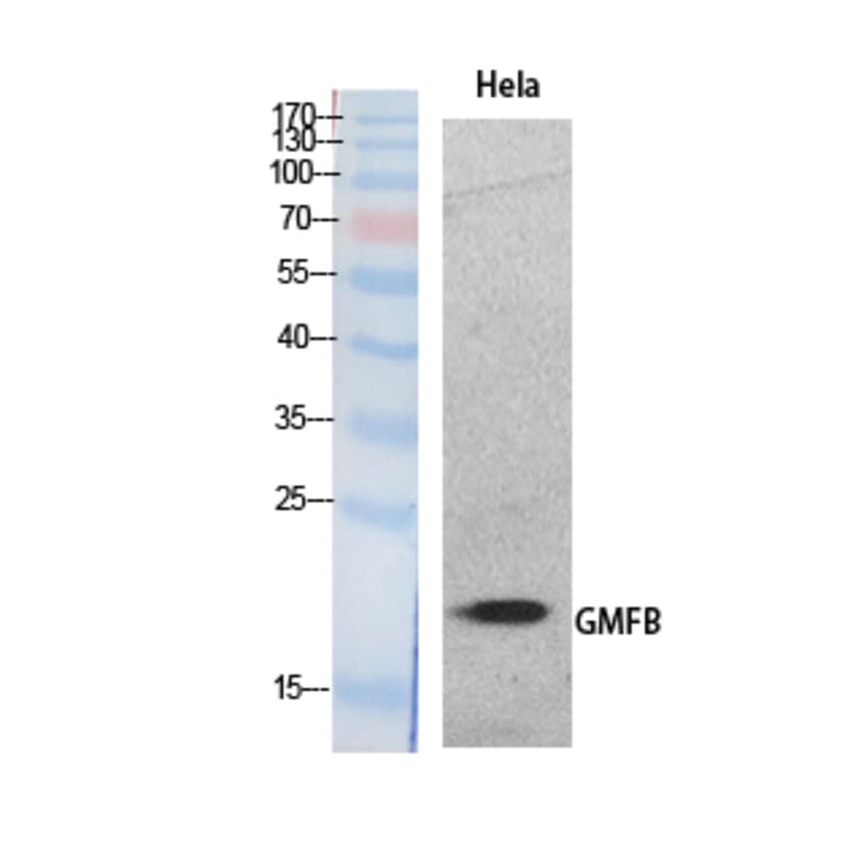 Western blot - GMF-β Polyclonal Antibody from Signalway Antibody (41883) - Antibodies.com