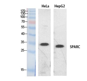 Western blot - SPARC Polyclonal Antibody from Signalway Antibody (41891) - Antibodies.com