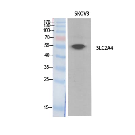 Western blot - Glut4 Polyclonal Antibody from Signalway Antibody (41893) - Antibodies.com