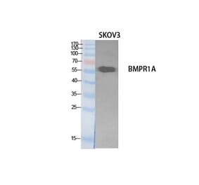 Western blot - CD292 Polyclonal Antibody from Signalway Antibody (41897) - Antibodies.com