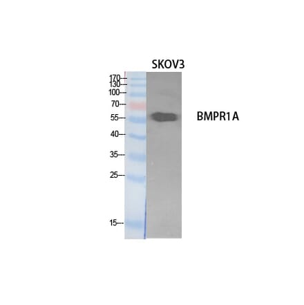 Western blot - CD292 Polyclonal Antibody from Signalway Antibody (41897) - Antibodies.com
