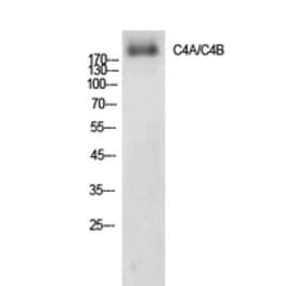 Western blot - C4a/b Polyclonal Antibody from Signalway Antibody (41908) - Antibodies.com