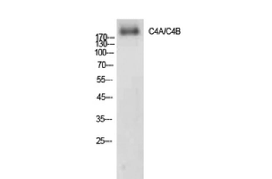 Western blot - C4a/b Polyclonal Antibody from Signalway Antibody (41908) - Antibodies.com