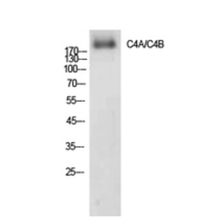 Western blot - C4a/b Polyclonal Antibody from Signalway Antibody (41908) - Antibodies.com