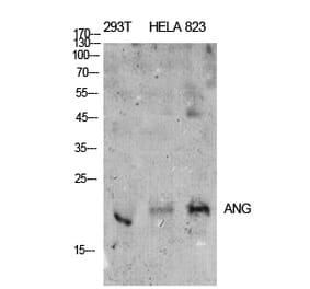 Western blot - ANG I Polyclonal Antibody from Signalway Antibody (41909) - Antibodies.com