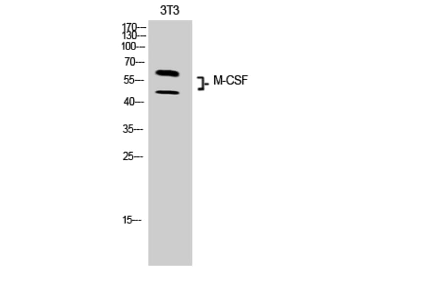 Western blot - M-CSF Polyclonal Antibody from Signalway Antibody (41919) - Antibodies.com