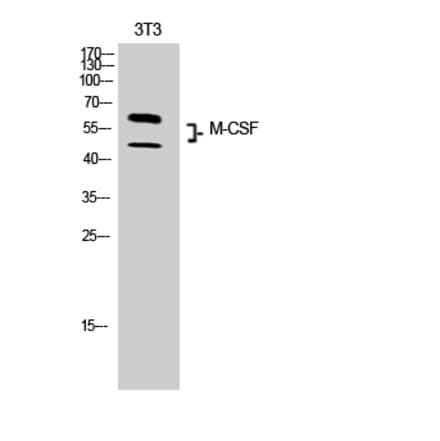 Western blot - M-CSF Polyclonal Antibody from Signalway Antibody (41919) - Antibodies.com
