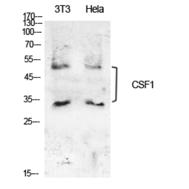 Western blot - M-CSF Polyclonal Antibody from Signalway Antibody (41919) - Antibodies.com