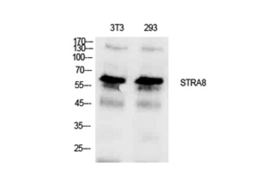 Western blot - Stra8 Polyclonal Antibody from Signalway Antibody (41923) - Antibodies.com