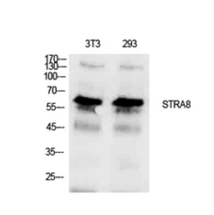 Western blot - Stra8 Polyclonal Antibody from Signalway Antibody (41923) - Antibodies.com