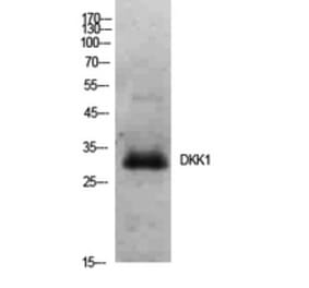 Western blot - Dkk-1 Polyclonal Antibody from Signalway Antibody (41928) - Antibodies.com