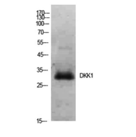 Western blot - Dkk-1 Polyclonal Antibody from Signalway Antibody (41928) - Antibodies.com