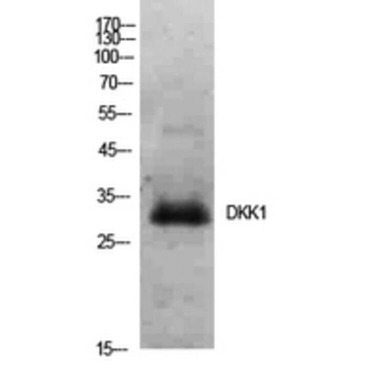 Western blot - Dkk-1 Polyclonal Antibody from Signalway Antibody (41928) - Antibodies.com