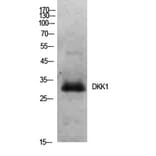 Western blot - Dkk-1 Polyclonal Antibody from Signalway Antibody (41928) - Antibodies.com