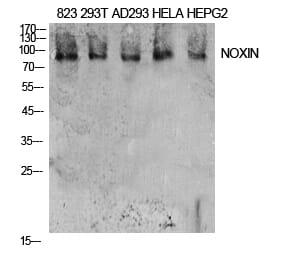 Western blot - NOXIN Polyclonal Antibody from Signalway Antibody (41930) - Antibodies.com