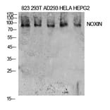 Western blot - NOXIN Polyclonal Antibody from Signalway Antibody (41930) - Antibodies.com