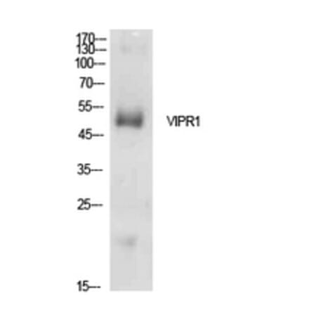 Western blot - VPAC1 Polyclonal Antibody from Signalway Antibody (41940) - Antibodies.com
