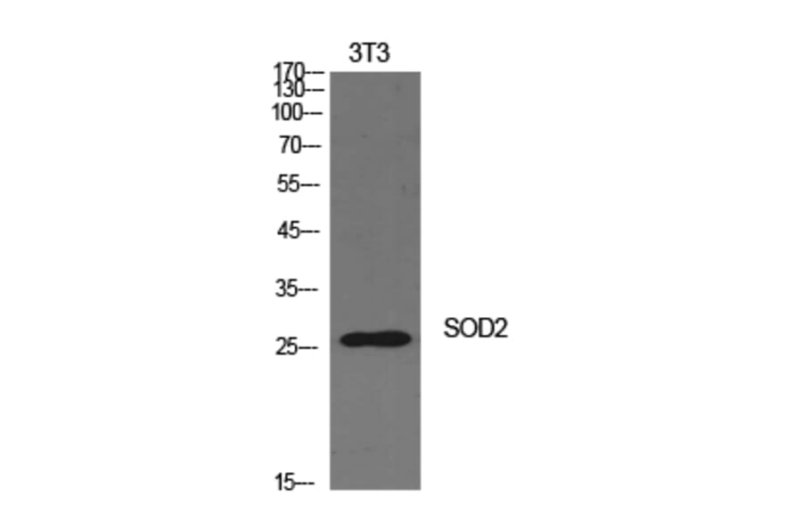 Western blot - SOD-2 Polyclonal Antibody from Signalway Antibody (41941) - Antibodies.com